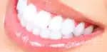 Clarear os dentes (Foto: Reprodução)