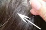 Arrancar um fio de cabelo branco (Foto: Reprodução/ Quora)