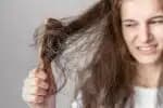 Saiba quais os cuidados para os cabelos ressecado no inverno! Foto: Reprodução 